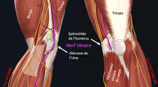 SYNDROME DU TUNNEL CUBITAL